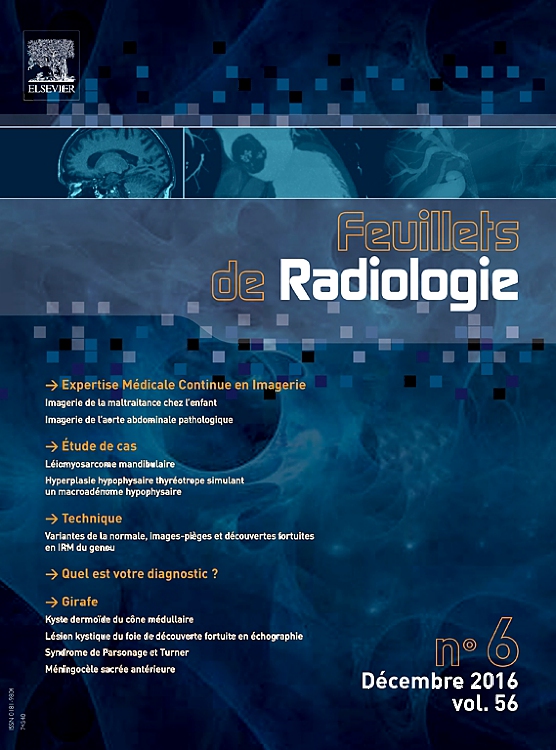 Go to journal home page - Feuillets de Radiologie